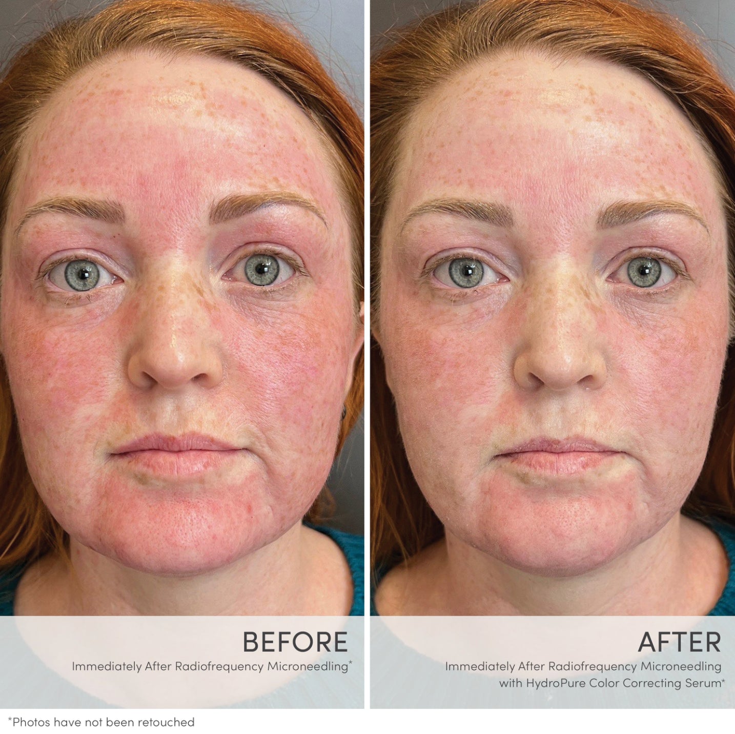 HydroPure Color Correcting Serum